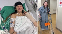 Woman pulled over on Colonial Drive loses leg after being struck by hit-and-run driver