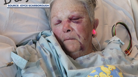Brevard County crossing guard relearns to walk, talk after being hit by SUV