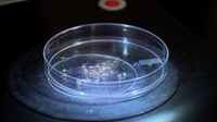 Dengue fever: 3 cases in Orange County; 152 local cases in Florida