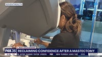 New robotic nipple-saving technology offers hope for breast cancer survivors in Florida