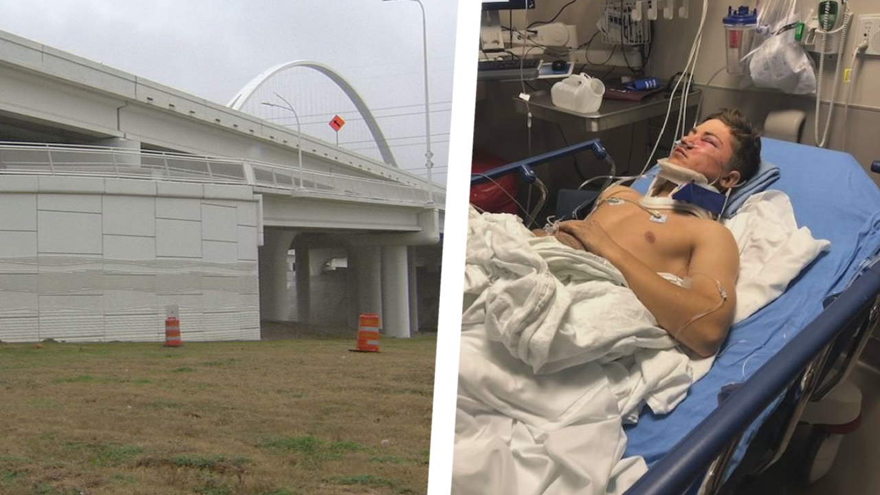Dallas Teen Trying To Take Selfie Survives Fall Off Bridge