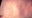 Texas measles outbreak 2025: State identifies 20 new cases, state total climbs to 561