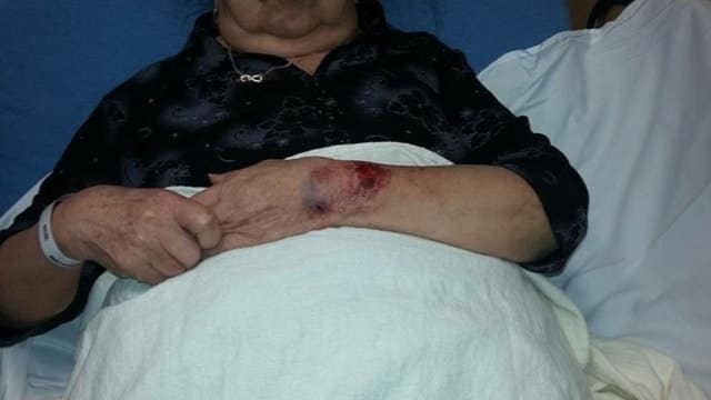 81-year-old woman mistaken for burglar bitten by Coon Rapids K-9
