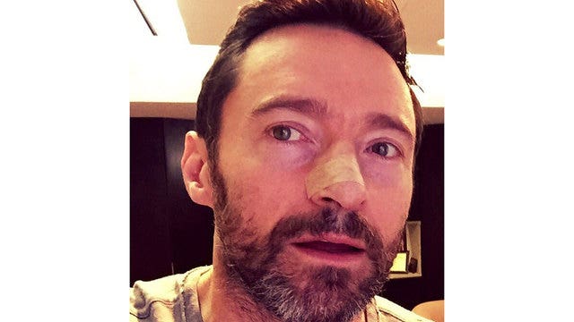 Hugh Jackman shares cancer photo