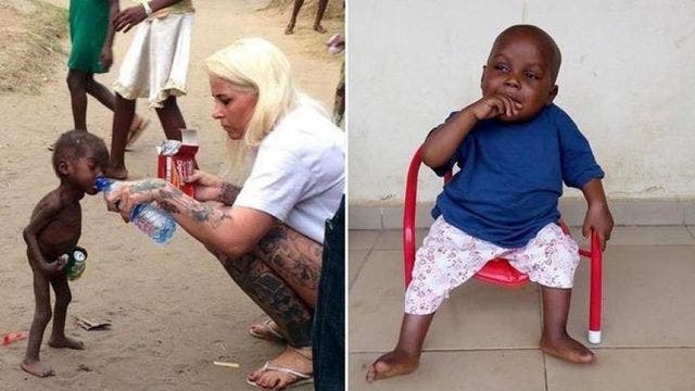 Starving toddler from viral photo thriving after rescue
