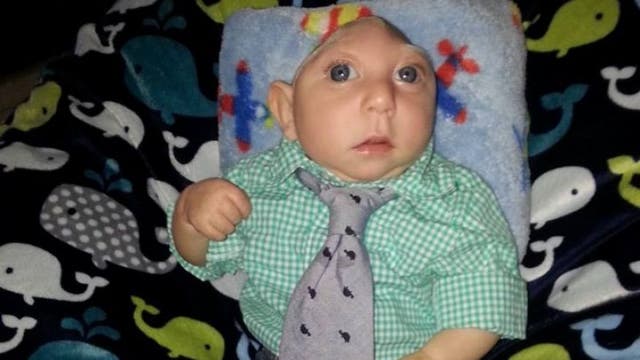 Boy born with severe brain malformation defies odds to celebrate first birthday