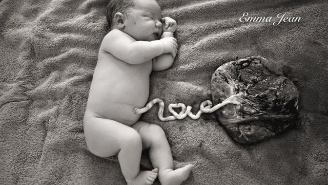 Photo of newborn and placenta goes viral