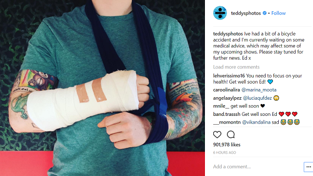 UK singer Ed Sheeran tells fans of bike accident, arm injury