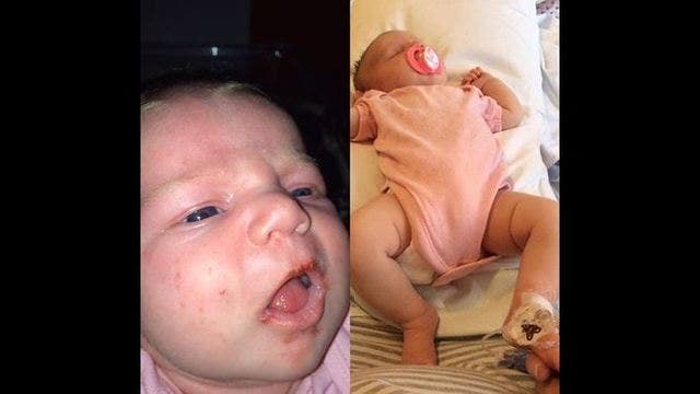 'A kiss on the lips nearly killed my baby', Mom has unthinkable scare