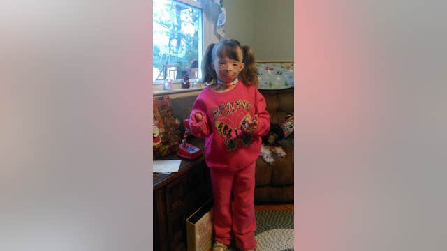 Girl who lost family in arson has one Christmas wish and needs the public's help