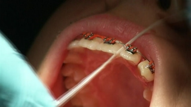 Medical benefits of dental floss unproven