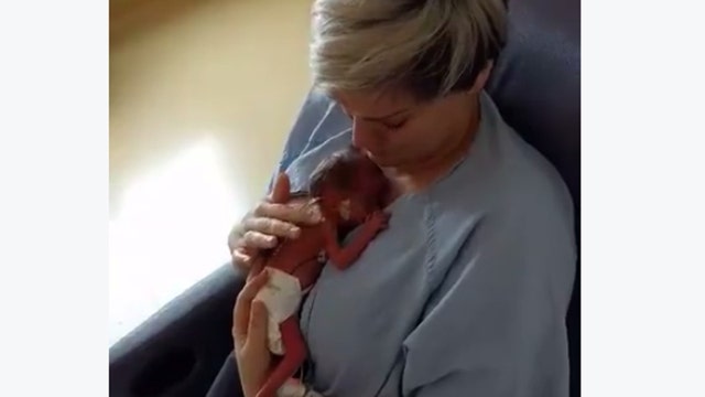 Video: Mom holds premature baby for first time