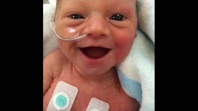 Smiling preemie photo makes the world smile