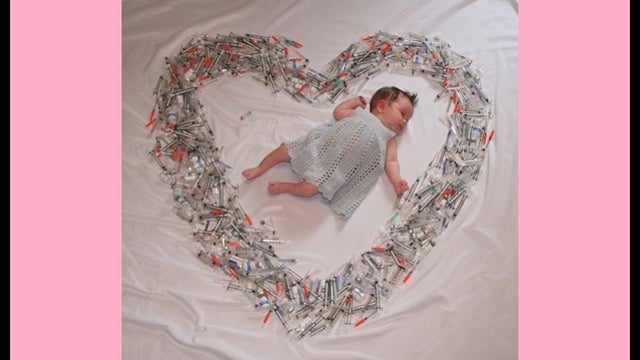 Photo of baby surrounded by heart of IVF syringes goes viral