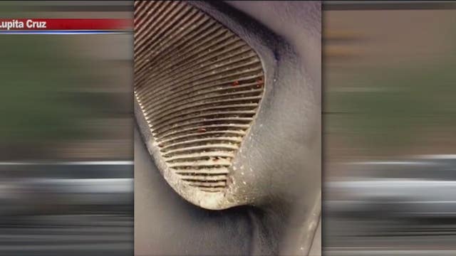 Man claims he was bitten by bed bugs while using Walmart motorized cart