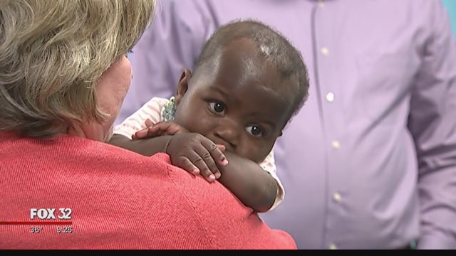 Baby born with 4 legs, 2 spines undergoes successful surgery