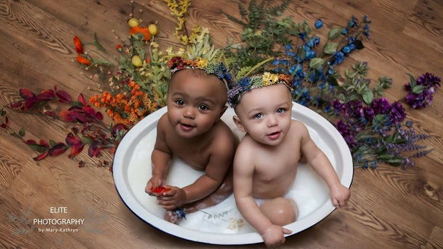 Twins with different skin color have message of love