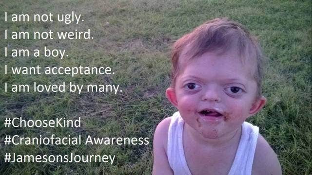 Mom hits back at trolls who turned disabled son's photo into Internet meme
