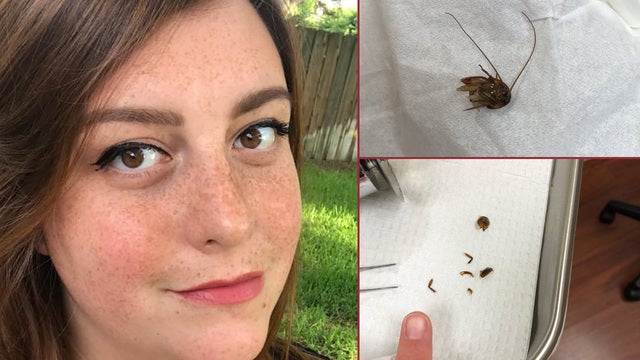 Florida woman's gruesome roach-in-ear tale goes viral