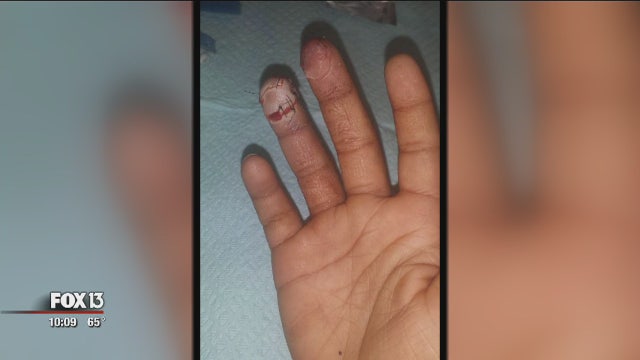 Lawyer: Teacher 'slammed' door on child's finger