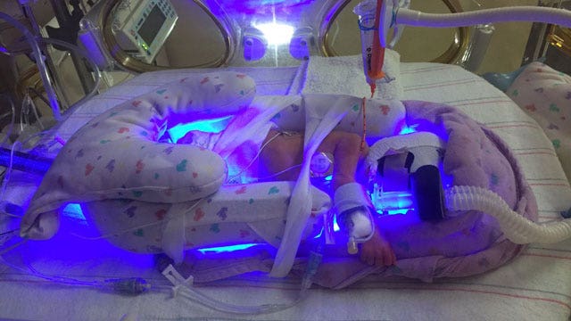 Valley mom gives birth to healthy quadruplets