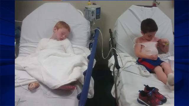 Boys badly burned during day care field trip