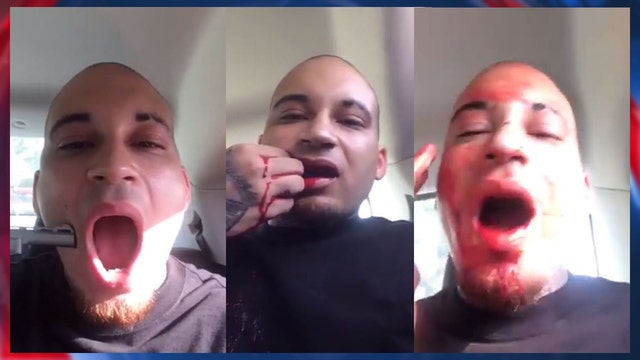 Rapper shoots himself in the face for music video