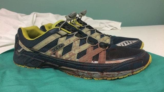 Orlando ER doctor shares photo of his blood-stained shoes