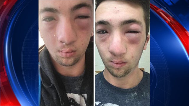 CMU student with allergy hazed with peanut butter while passed out, mother says