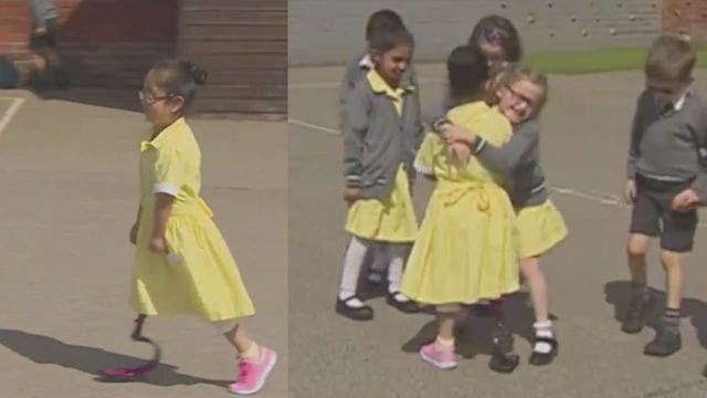 Little girl shows off new prosthetic leg to classmates in a heart melting video