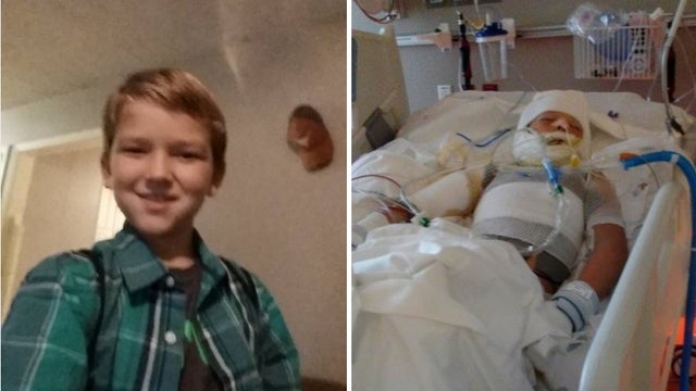Texas boy fights for life after he was set on fire