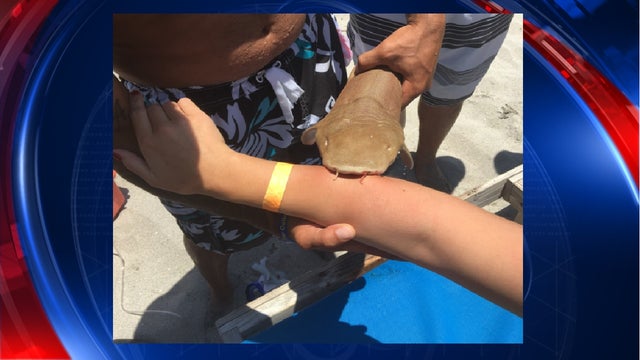 Woman taken to hospital with shark still attached to her arm
