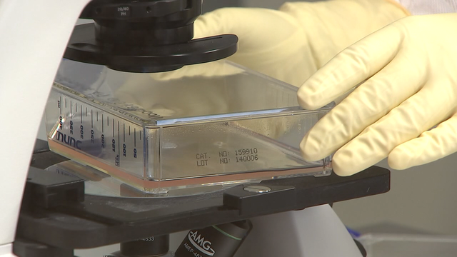 Former Dallas Cowboys turning to stem cell treatments