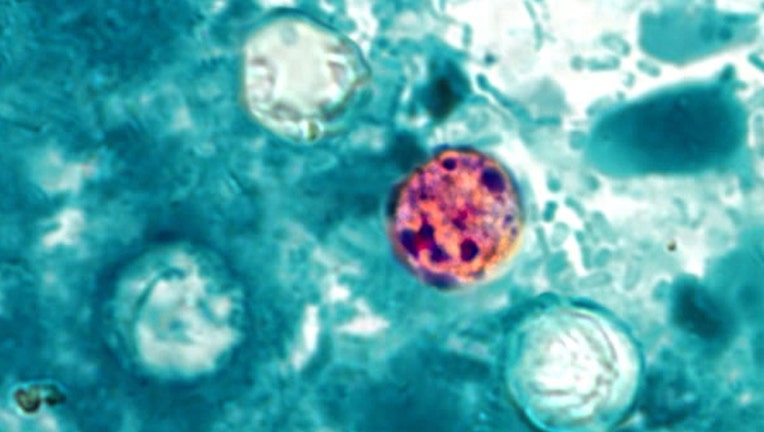 4aa0836f-cyclospora_1500482771063.jpg