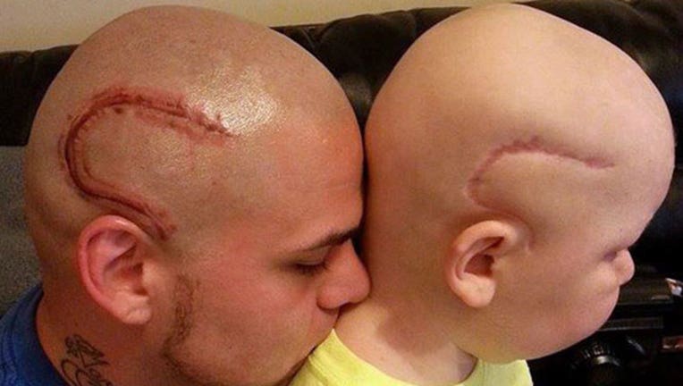 Dad Gets Tattoo to Match Son's Surgery Scar-402970