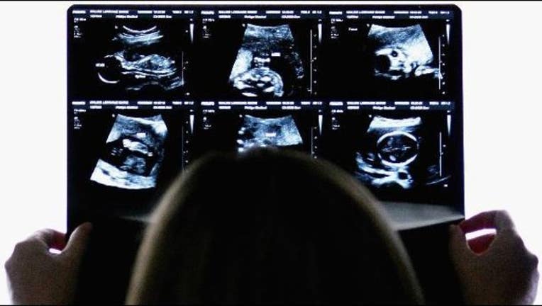 67e2e287-ultrasound-baby-getty_1551728068559-405538.JPG