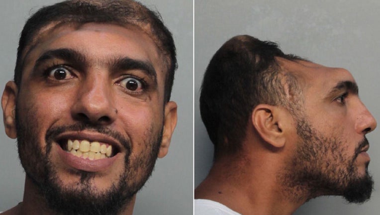 Florida Man With Half A Head Arrested For Attempted Murder | FOX 4 ...