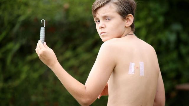 Boy, 12, survives 'freak' trampoline accident after metal spring shot into his back 'like a bullet'