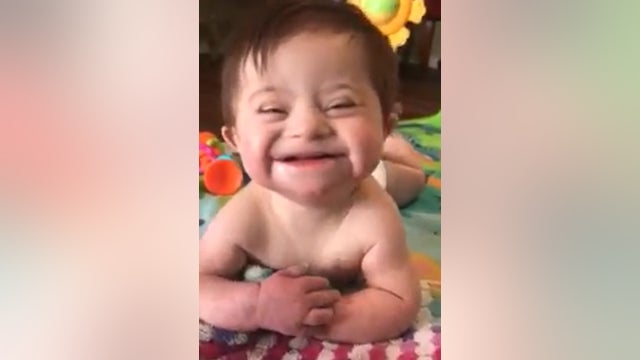 Video of adopted girl with Down syndrome smiling from ear to ear goes viral