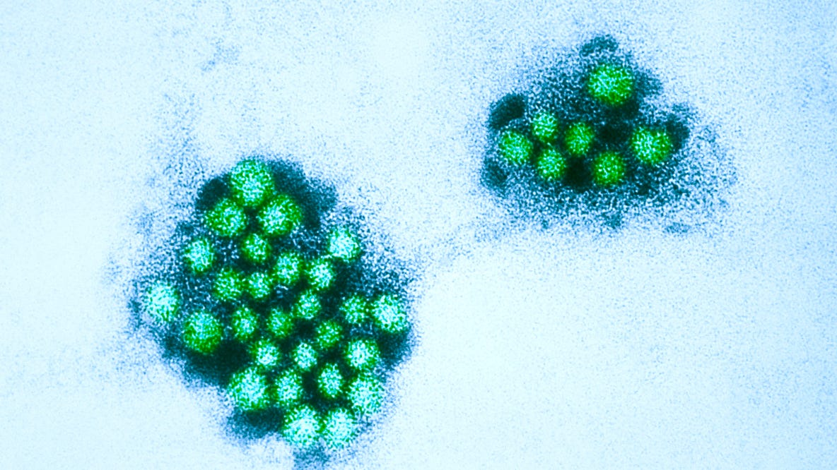 Norovirus outbreak forces North Texas middle school to shut down