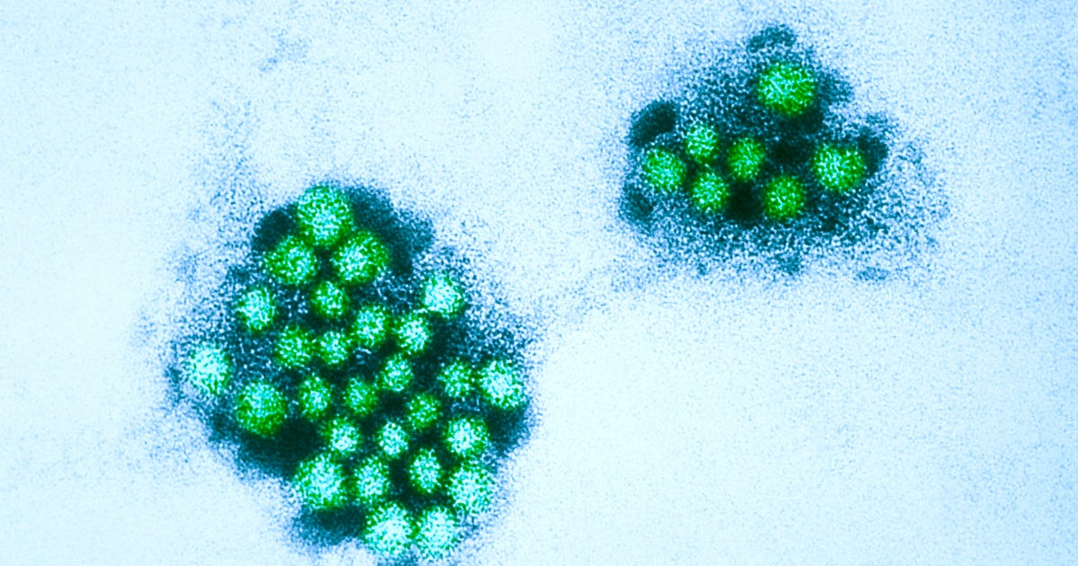 Norovirus outbreak forces North Texas middle school to shut down