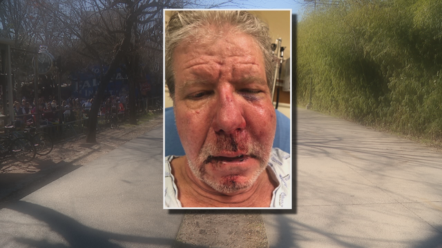 Man randomly attacked while walking along the Katy Trail