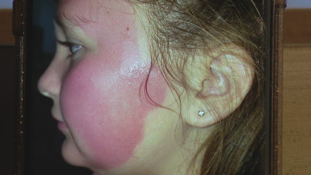 On Your Side: Face Mask Concerns