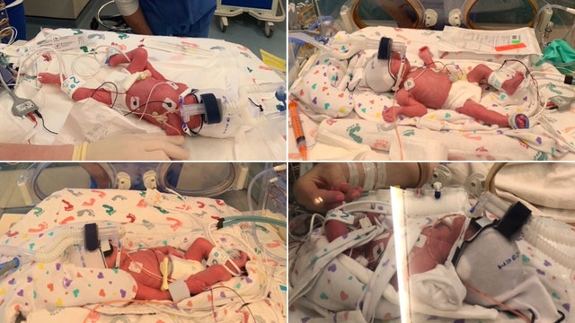 Dallas family welcomes identical quadruplet boys