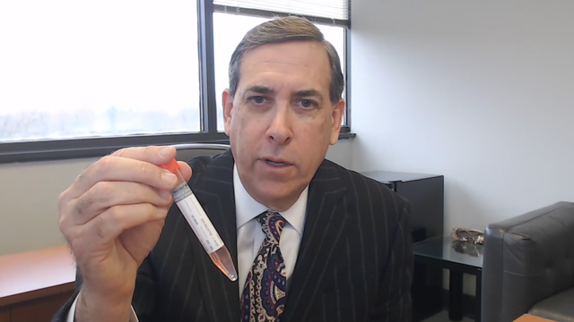 North Texas doctors await testing kits for the COVID-19 virus