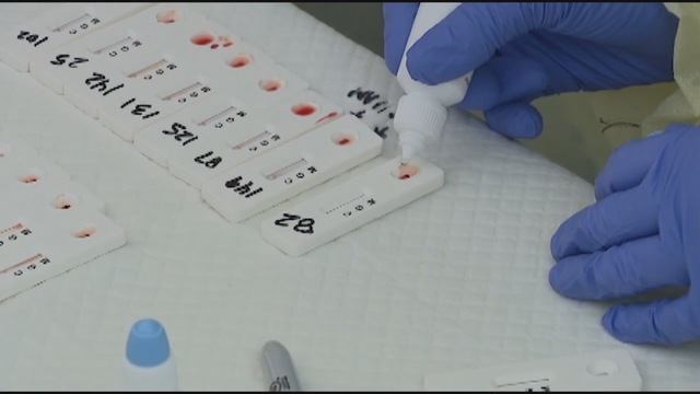 American Medical Association cautions public on reliability of COVID-19 antibody tests