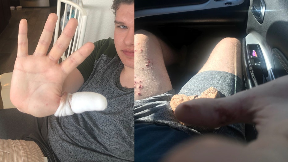 NC_TEEN_SURVIVES_SHARK_ATTACK__STILLS___NCSHARK.jpg