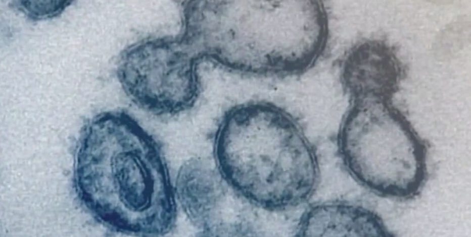 COVID cases rise in North Texas as students return to school