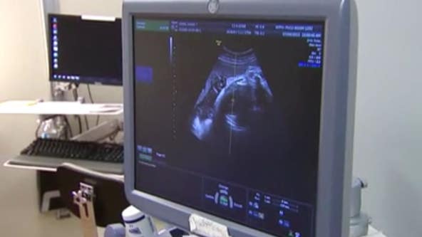 Gov. Abbott promises to ‘eliminate all rapists’ while defending Texas’ new abortion law