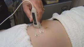 House Bill 44 aims to clarify exceptions to Texas' strict abortion law